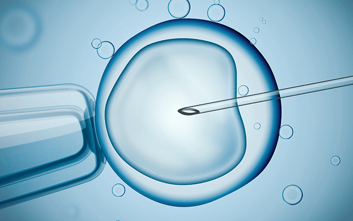 IVF Treatment